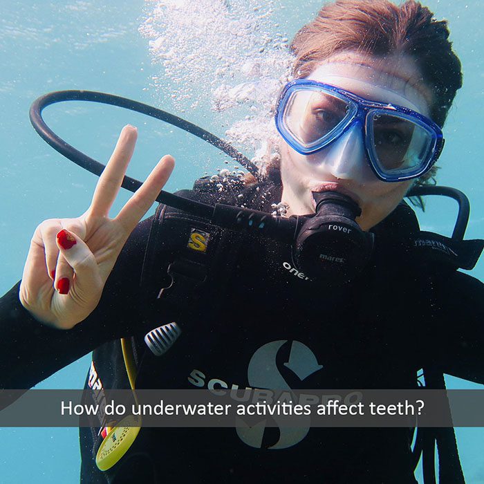 underwater teeth 2022 700 Scripps Poway Orthodontics