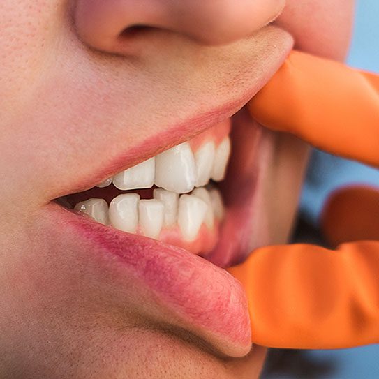 speech impediments 2025 543 Scripps Poway Orthodontics
