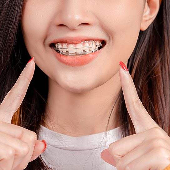retainer care 2025 543 Scripps Poway Orthodontics