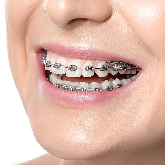 ortho mechanics 2026 543 Scripps Poway Orthodontics